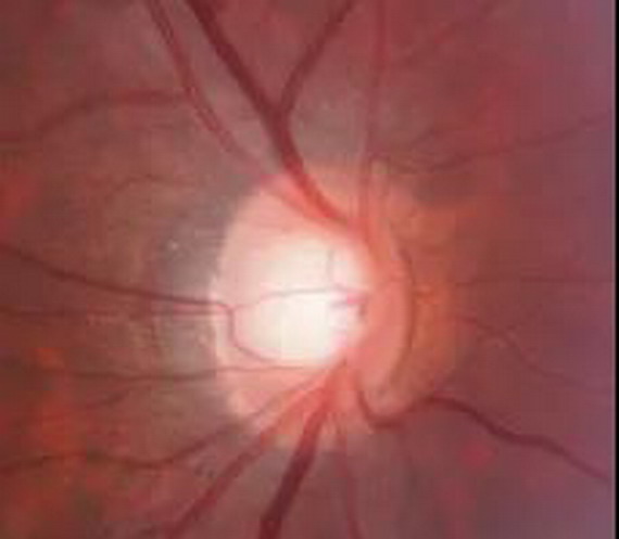 微信圖片_20210309104602_縮小大小.jpg 微信圖片_20210309104602_縮小大小.jpg